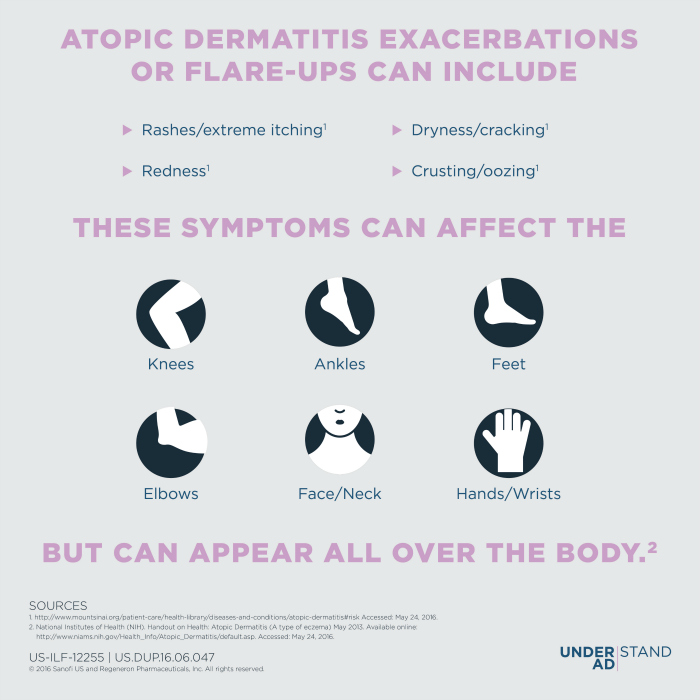 Educating People about Atopic Dermatitis symptoms graphic